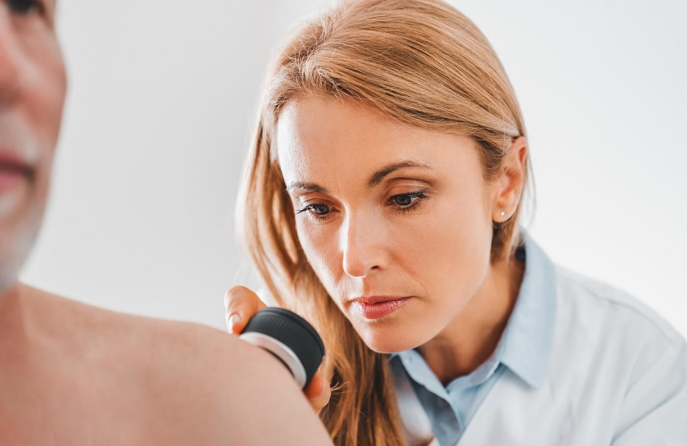 Photo of dematologist doing a skin cancer screening on patient.